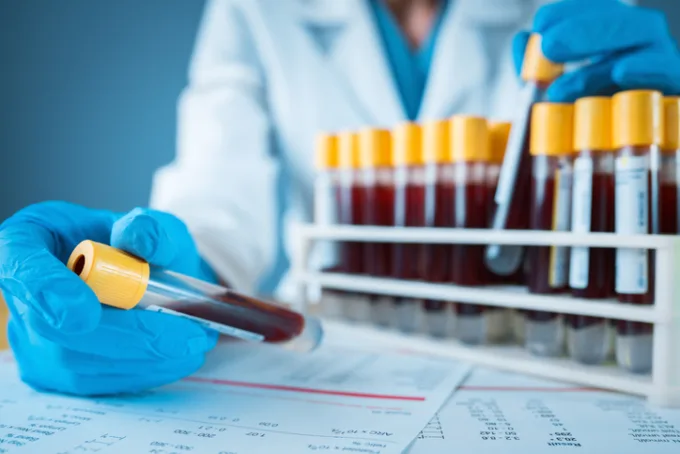 Laborant drží krevní vzorek v testovací zkumavce vedle stojanu s dalšími.