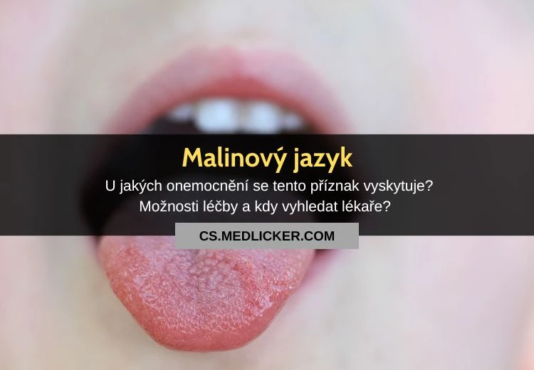 Přiblížený pohled na malinový jazyk u člověka.