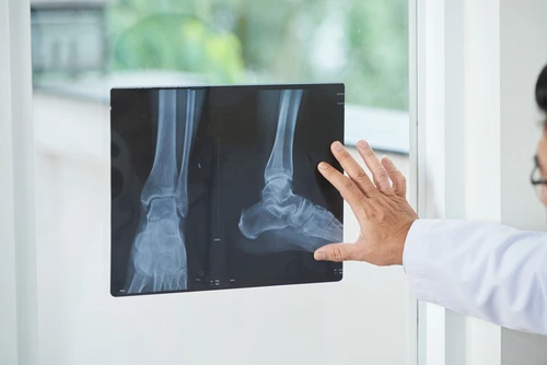 Lékař zkoumá rentgenovou snímek nártu pro diagnostiku bolesti bez příčiny.