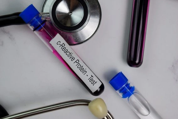 Krevní vzorek pro testování C-reaktivního proteinu s fonendoskopem.