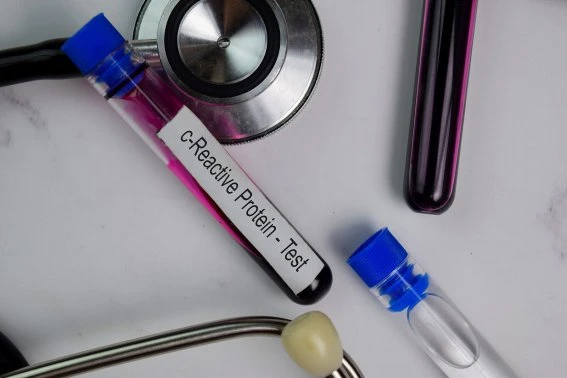 Krevní vzorek pro testování zánětu s fonendoskopem.