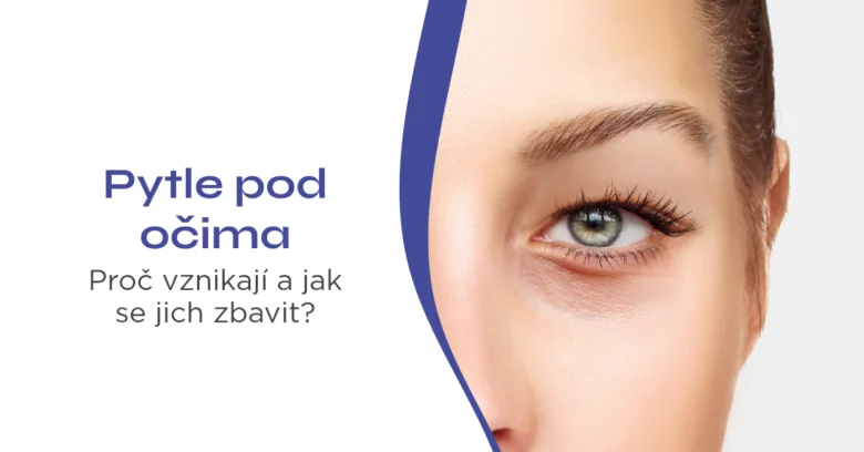 Žena s otoky pod očima - příčiny a léčba