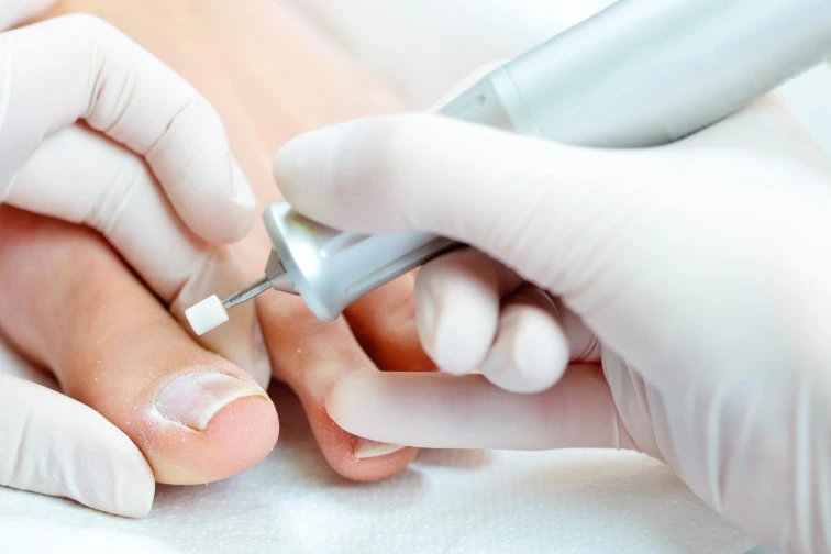 Pedicurista upravuje nehet nohy elektrickým pilníkem.