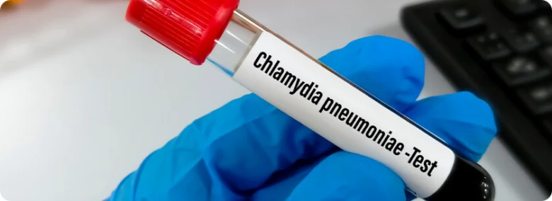 Chlamydia test tube