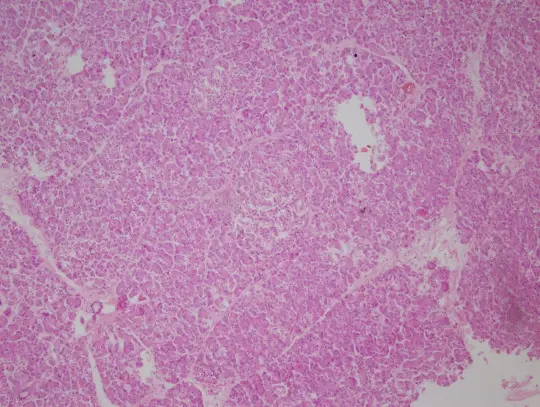 Histologický přípravek pankreatu s žlázovými buňkami.