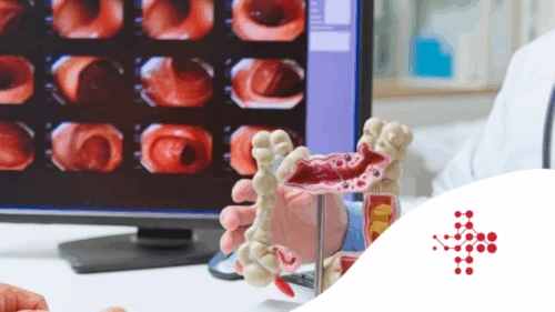 Lékař drží anatomický model čelisti před monitorem s rentgenovými snímky.