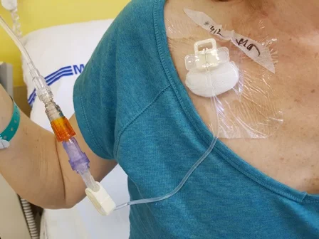 Picc line on patient chest and arm