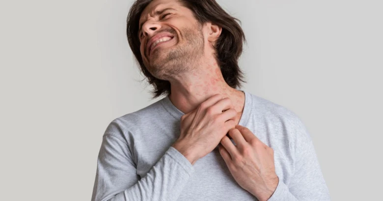 Man with rash scratching neck