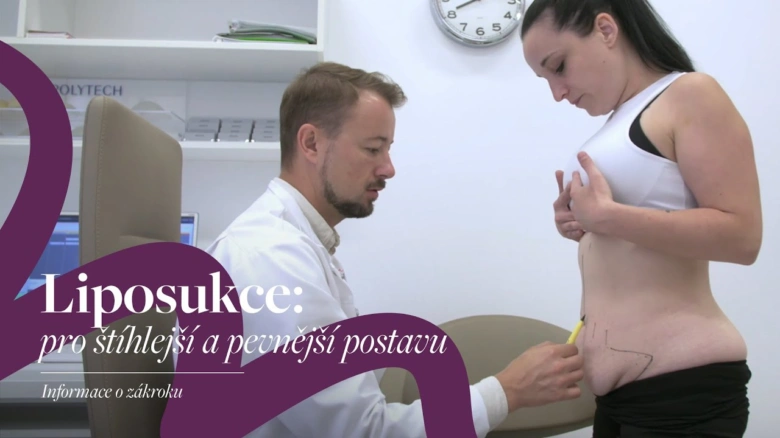 Lékař označuje pacientovi břicho před liposukcí v ordinaci.