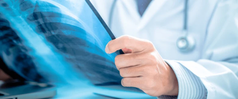 Lékař zkoumá rentgenový snímek plic pro diagnostiku.