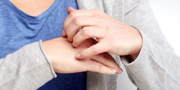 Osoba škrábe ruku kvůli vyrážce nebo svědění.