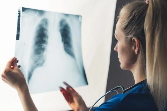 Doctor examining chest x-ray
