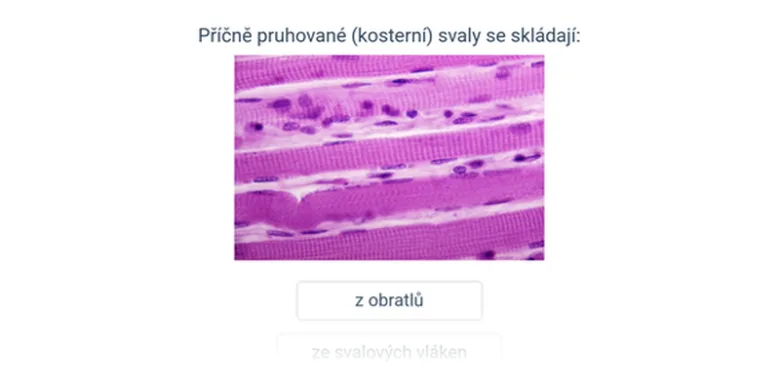 Mikroskopický snímek příčně pruhovaného kosterního svalu ukazuje svalová vlákna a jádra.