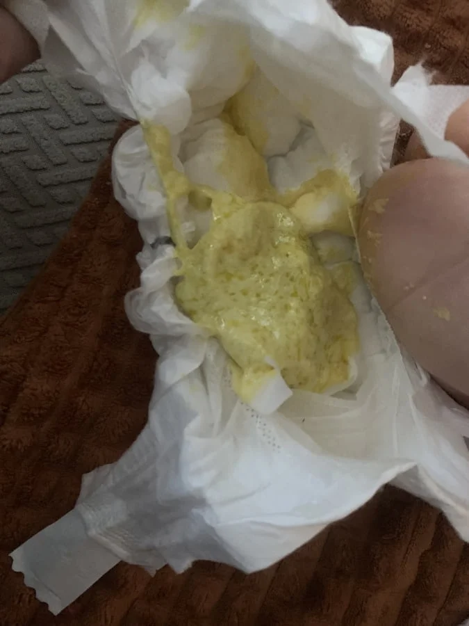 Žlutá stolice novorozence v plenkách s bílými zrnky.