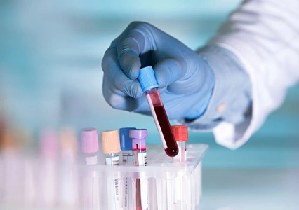 Blood test tubes in rack