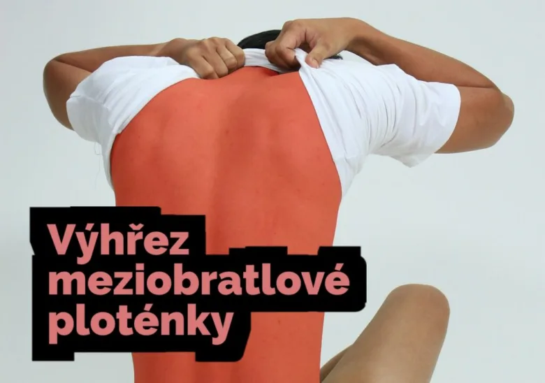 Muž ukazuje na záda s výhřezem ploténky.