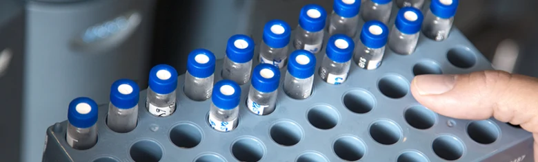 Laboratorní sklenice s tekutinou pro krevní testy.