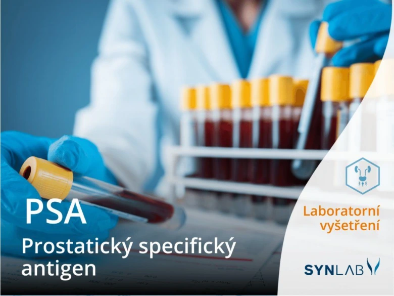 Laboratorní vyšetření prostaty pomocí krevního PSA antigenu.