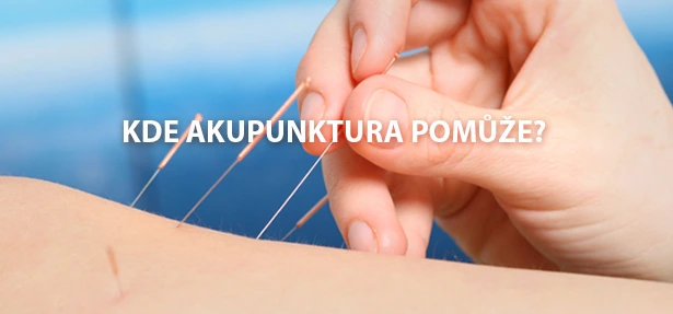 Ruční vkládání jehel akupunktury do předloktí pacienta.