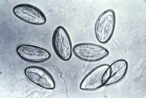 Mikroskopický pohled na vejce pinwomu Enterobius vermicularis.