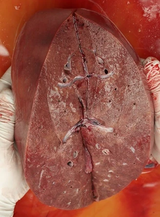 Průřez lidským játrek s viditelnými cévami v anatomickém kontextu.