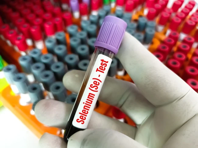 Ruka drží zkumavku na krevní sérum selenium v laboratoři.