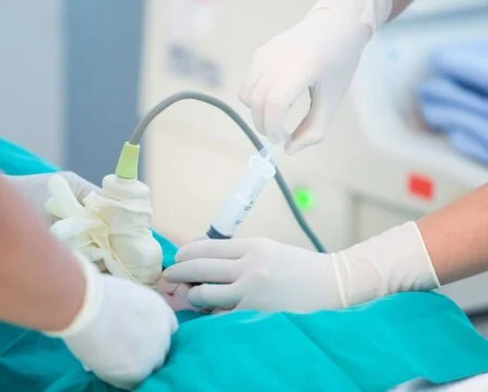 Ruce v rukavicích provádějí lékařský zákrok s jehlou pro nidační krvácení