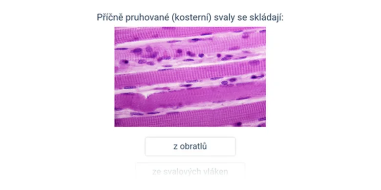 Mikroskopický snímek příčně pruhovaných svalových vláken s jádry
