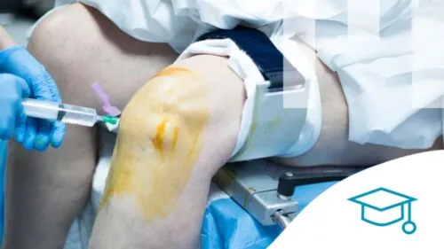 Intervenční radiologický zákrok na koleni pacienta s použitím ultrazvuku.