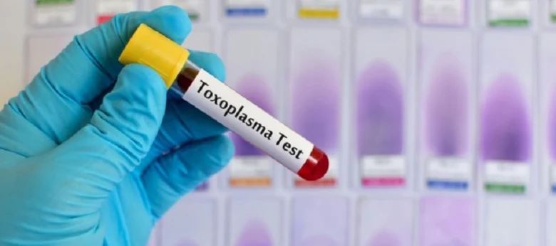 Ruka drží zkumavku s krví pro test toxoplazmózy.
