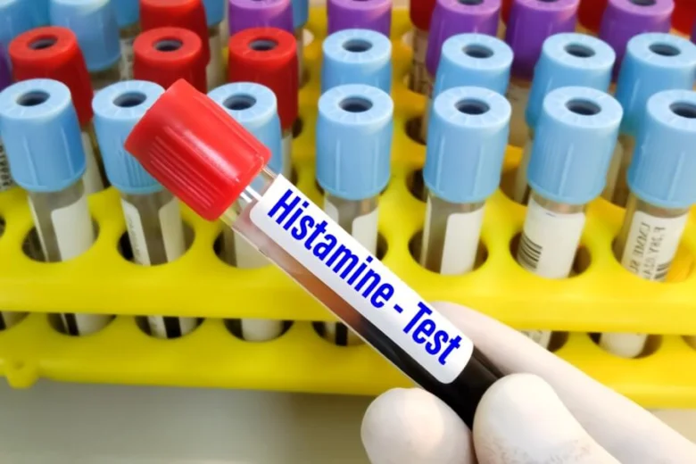 Krevní vzorek pro test histaminu držený rukou s latexovou rukavicí.
