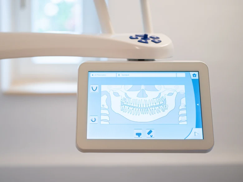 Digitální zobrazovač rentgenového snímku zubů v ordinaci