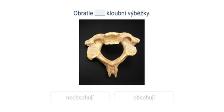 Fotografie lidského obratle s kloubními výběžky na černém pozadí.