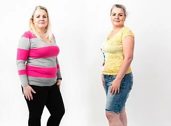 Woman before and after weight loss