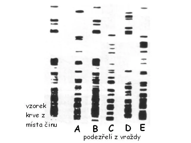 DNA profil z místa činu srovnávaný se vzorky podezřelých A až E.